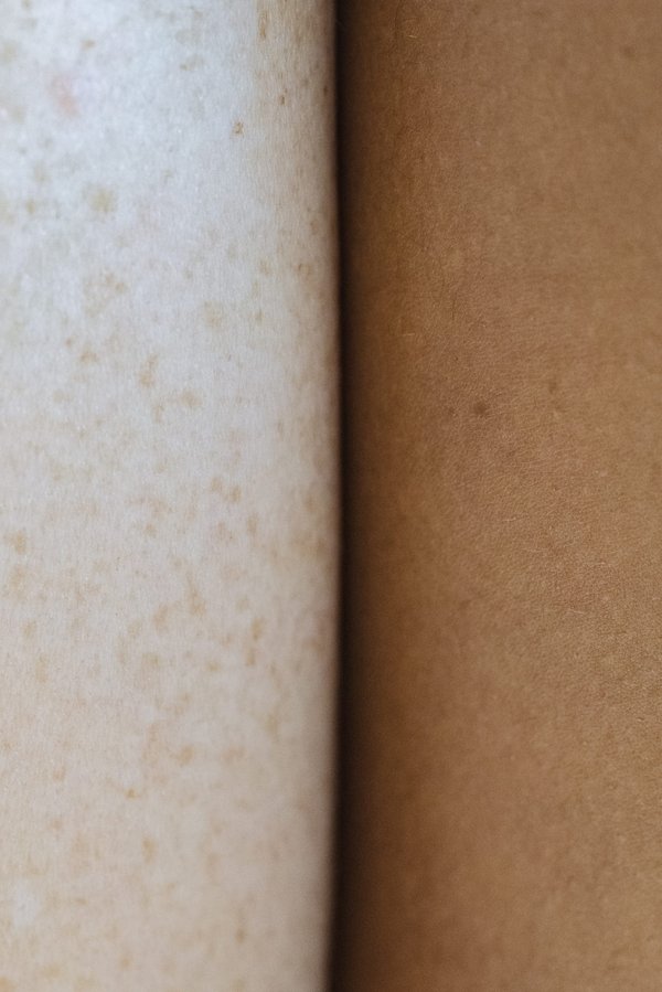 Pourquoi mon chien me lèche la partie intime ?